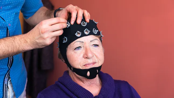 alzheimer inteligencia artificial